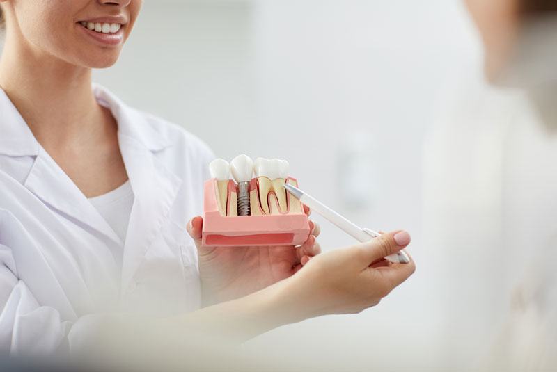 female dentist explaining dental implant procedure