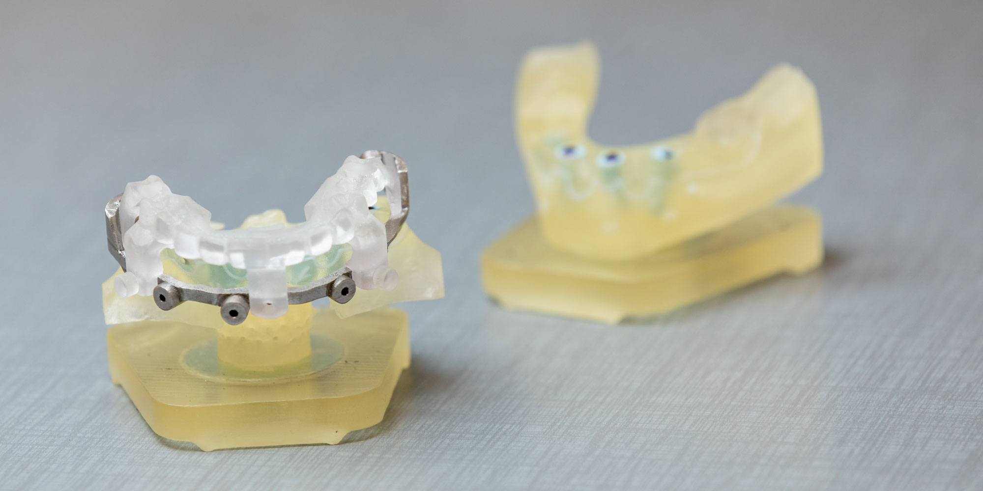 dental implant guide with model before prosthesis